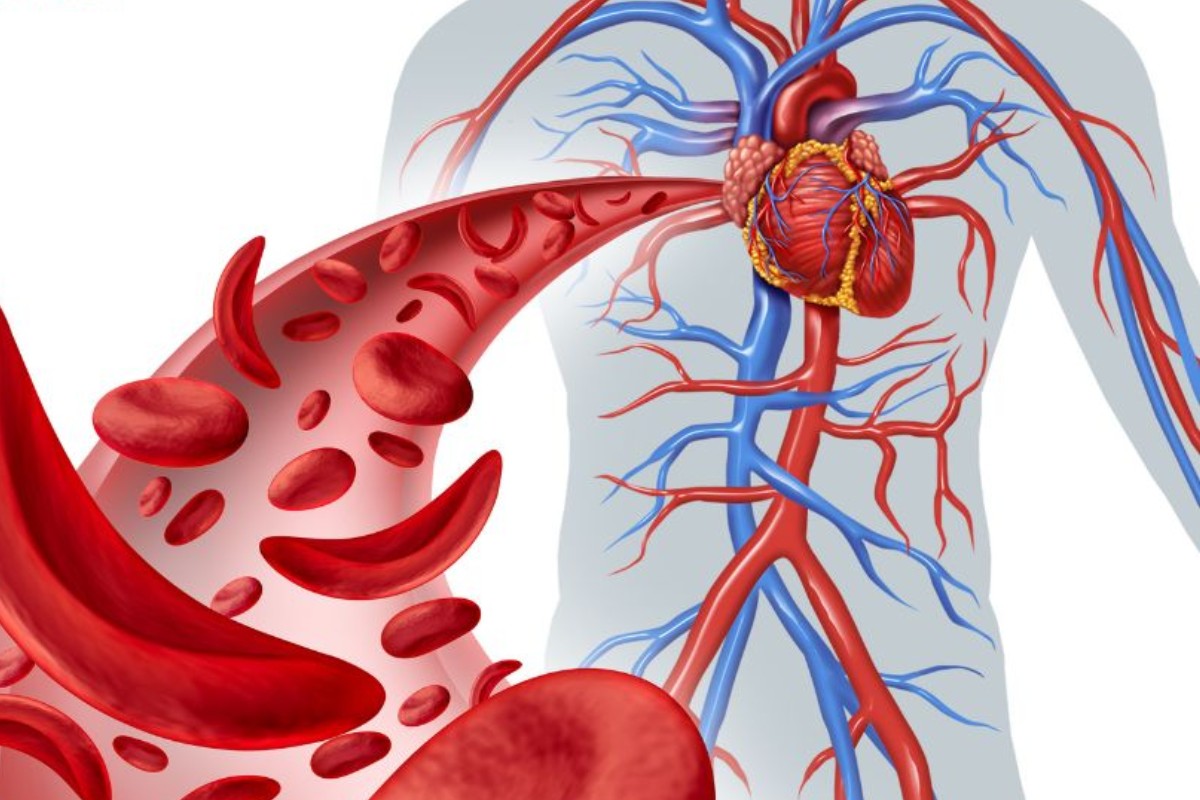 Ngồi sai tư thế gây tắc nghẽn tuần hoàn máu